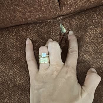 Ergül Mobilya’da Koltuk Takımının Kısa Sürede Yırtılması Ve Kumaş Sorunları