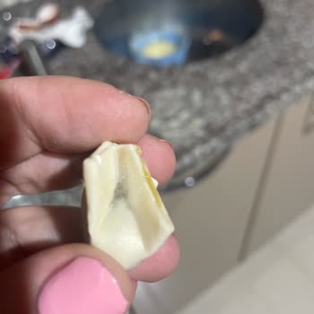 Ülker Superfresh Dondurulmuş Mantıdan Ciddi Gıda Zehirlenmesi Ve Sağlık Masrafları İadesi Talebi