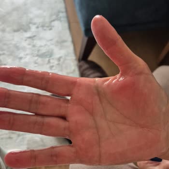 Pirantech CB-107C Buhar Makinesinde Su Kaçırma Ve Yanma Sorunu