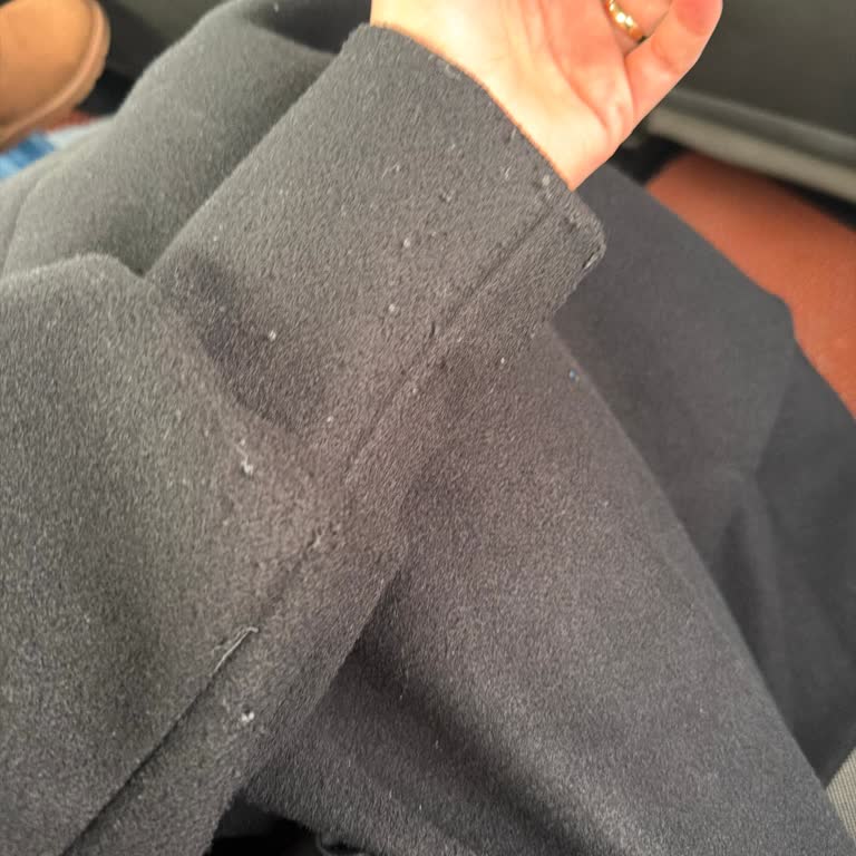 Sidelya Collection Kabanın Tüylenmesi Ve Alaycı İşletme Yanıtı