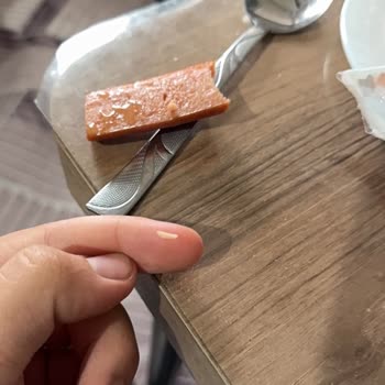 Banvit Sosisinde Tırnak Benzeri Yabancı Cisim Keşfi Ve Sağlık Riski