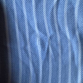 Mavi Gömlekte Kısa Sürede Yaka Sökülmesi Ve Kullanıcı Hatası İddiasının Reddedilmesi