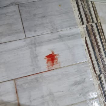 Arya Termal Otel Kırık Havuz Fayansından Çocuğumun Parmağı Kesildi