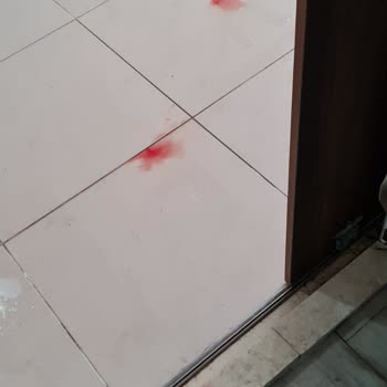 Arya Termal Otel Kırık Havuz Fayansından Çocuğumun Parmağı Kesildi