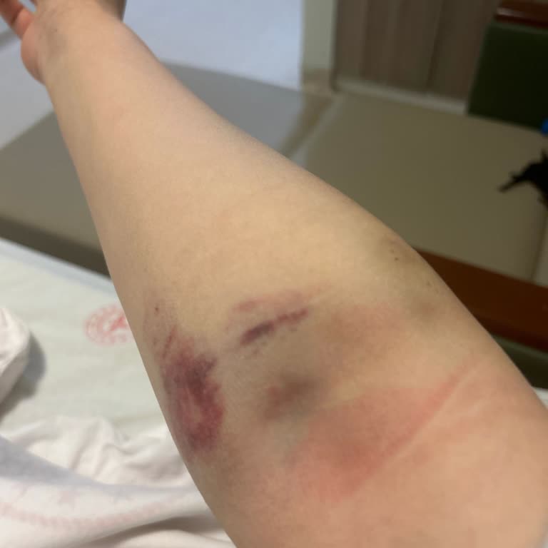 112 Acil Servis'te Kan Alınamaması Ve Sevk Edilmemesi Nedeniyle Yaşanan Ağır Acı Ve İhmal