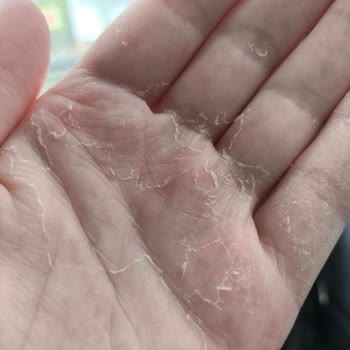 Evony Soft Care Sıvı Sabunu El Derilerini Soydurdu, Şikayetimize Cevap Gelmedi