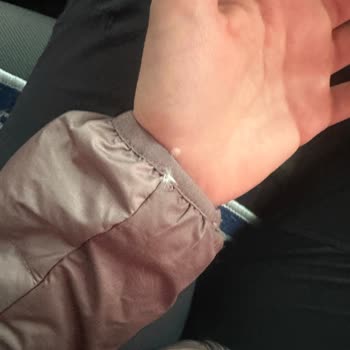 Garanti İsteği Ve İade Talebi: Kaz Tüyü Çıkan Adidas Mont