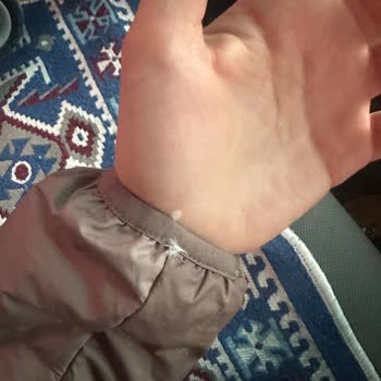 Garanti İsteği Ve İade Talebi: Kaz Tüyü Çıkan Adidas Mont