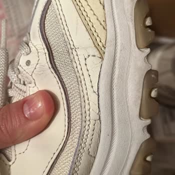 Skechers Dlites Ayakkabısının Üç Ayda Çatlaması Kullanıcı Hatası Değil