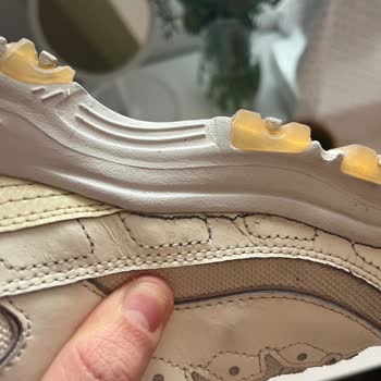 Skechers Dlites Ayakkabısının Üç Ayda Çatlaması Kullanıcı Hatası Değil