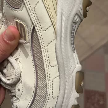 Skechers Dlites Ayakkabısının Üç Ayda Çatlaması Kullanıcı Hatası Değil