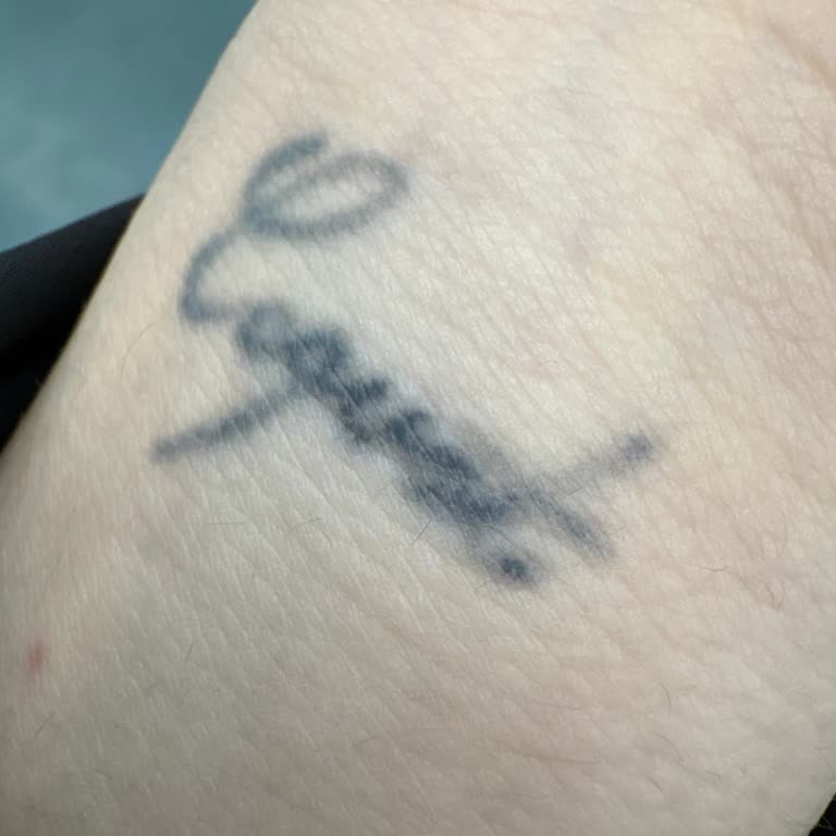 Dövmemin Yanması Ve Sürekli Personel Değişikliği