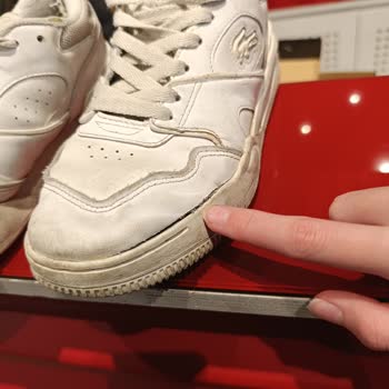 Lacoste Ayakkabımda Garanti Kapsamındaki Deforme Sorunu Reddedildi