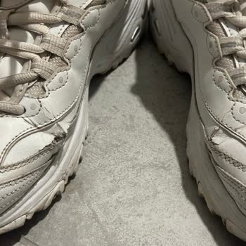 Skechers Ayakkabının Hızlı Yırtılması Ve Ücret İadesi Talebi