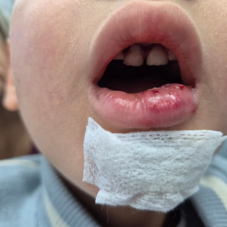 Playland Oyun Alanındaki Güvensiz Merdiven Çocuğumun Dişlerini Kırdı