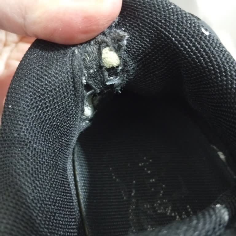 Ayakkabının Topuk Astarı Yırtıldı, Ayağım Yaralandı Ve İnceleme Reddedildi