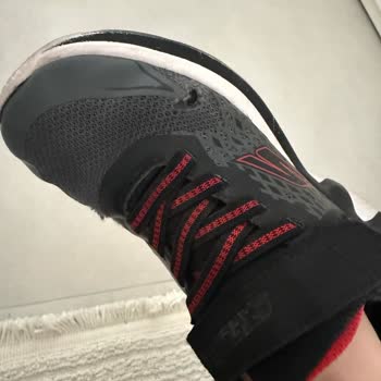 Skechers Çocuk Ayakkabısında Erken Yırtılma Ve Ücret İadesi Talebi