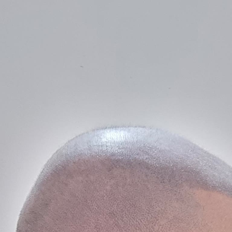 Saç Simülasyonu İşlemi Ağrılı Ve Sonuç Doğal Olmadı, 30 Bin TL Ücretine Şikayet