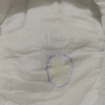 Molfix Bebek Bezlerinde Silikon Damlaması Sorunu: Tekrarlayan Üretim Hatası