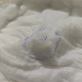 Molfix Bebek Bezlerinde Silikon Damlaması Sorunu: Tekrarlayan Üretim Hatası