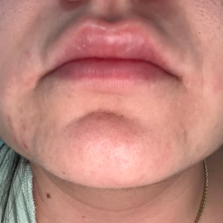 Dr.Gunay Yusubova Kendimi Tamamen Değersiz ve Başıboş Bırakılmış Hissettim