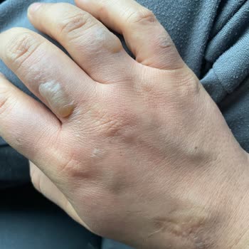 Emsan Mutfak Şikayeti