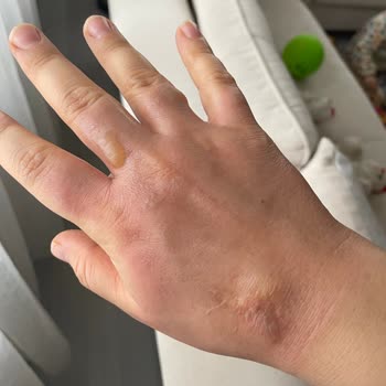 Emsan Mutfak Şikayeti