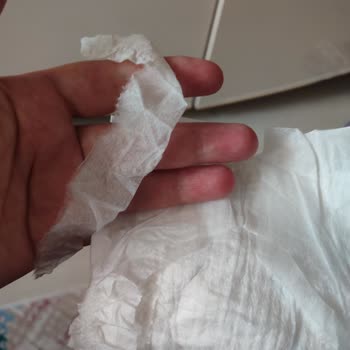 Molfix Bebek Bezinde Parça Kaçağı Ve Hijyen Endişesi