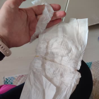 Molfix Bebek Bezinde Parça Kaçağı Ve Hijyen Endişesi