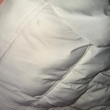 Kuru Temizlemede Montum Çamurlandı Ve Fermuarı Soyuldu, Şube Umursamaz Davranış Sergiledi