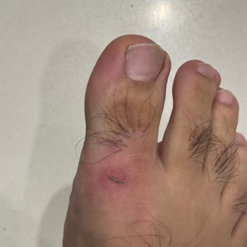 Baş Parmak Tasarımındaki Hata Ayağımı Yaraladı, Kiğılı’dan Değişim Talebi