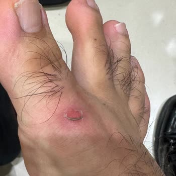 Baş Parmak Tasarımındaki Hata Ayağımı Yaraladı, Kiğılı’dan Değişim Talebi