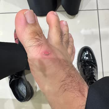 Baş Parmak Tasarımındaki Hata Ayağımı Yaraladı, Kiğılı’dan Değişim Talebi