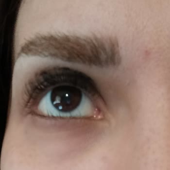 Kaş Laminasyonu Ve Kirpik Liftingi Sonrası Kötü Sonuç Ve İade Reddi