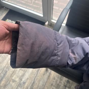 Gant Montunda Renk Aşınması Ve Garanti Sürecindeki İhmalkârlık