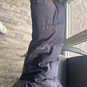 Gant Montunda Renk Aşınması Ve Garanti Sürecindeki İhmalkârlık