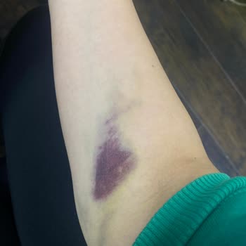 Kayıt Personelinin Saygısız Davranışı Ve Kan Alımından Morluk