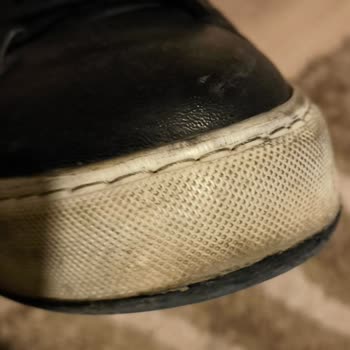 Garanti Kapsamında Tamir Sonrası İzleme Yok, Ayakkabım Tekrar Açıldı