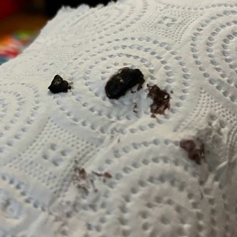 Migros Pols Freeze Fresh Fruit Mix Ürününün İçinde Kara Yabancı Madde Ve Bebek Sağlığı Riski