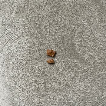 Ceviz İçindeki Kabuk Parçaları Dişimi Kırdı Ürün İadesi Talebi