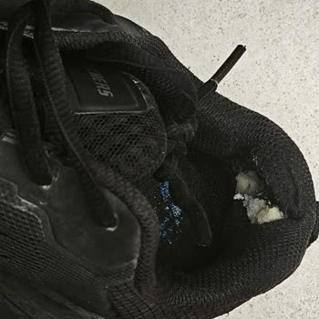 Skechers Ayakkabısının 8 Ayda Yırtılması Ve Servisin Kullanıcı Hatası İddiası