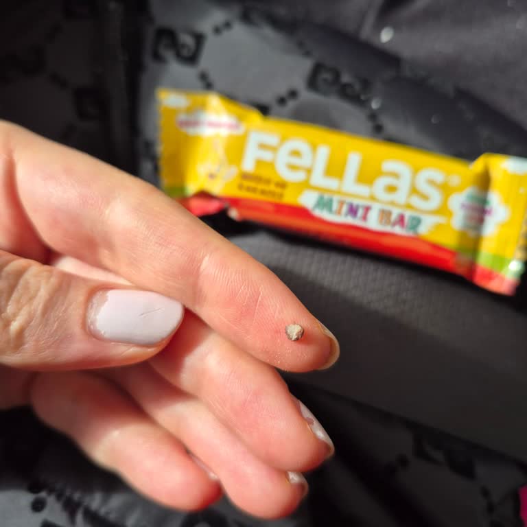 Vitamin Bar’da Taş Çıktı Ve Dişime Yakın Kırılma Tehdidi