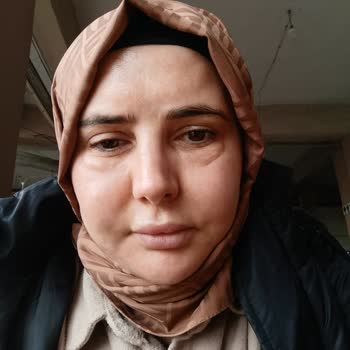 Derin Dindin Güzellik Merkezi Yüz Şişliği Ve Göz Altı Şişmesi Nedeniyle Mağduriyet