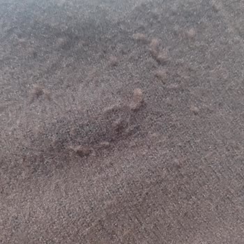 Aşırı Tüylenme Ve Deformasyon Yaşatan Elbise İçin Fiş Talebiyle Mağduriyet