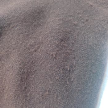 Aşırı Tüylenme Ve Deformasyon Yaşatan Elbise İçin Fiş Talebiyle Mağduriyet