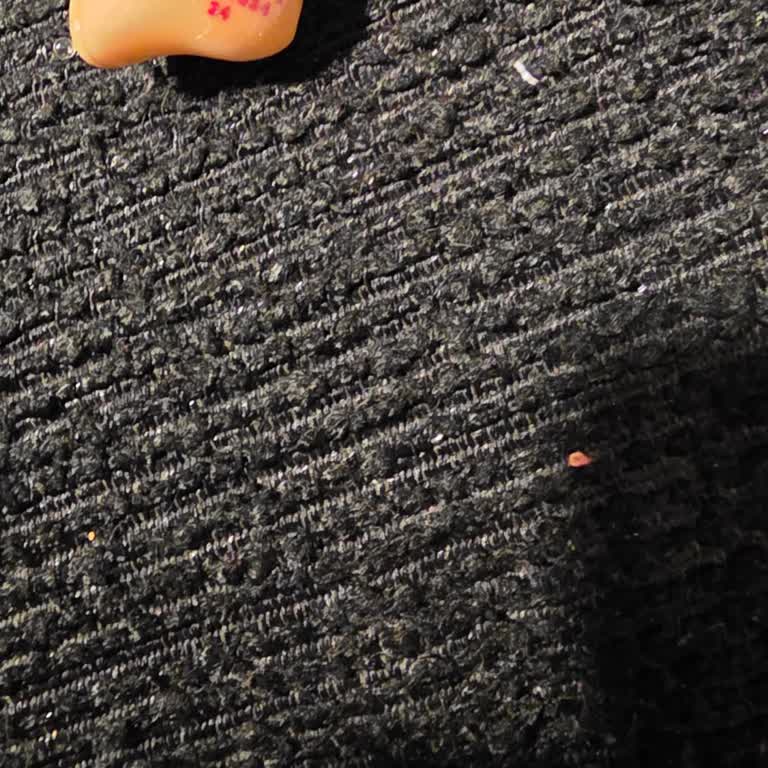 Anneme Ait Oticon İşitme Cihazı Sürekli Arızalı, Servis Çözümü Yok, Değişim Talep Ediyorum