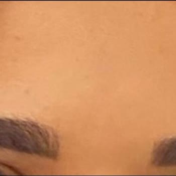 Muse Beauty Kaş İşleminde Renk Değişikliği Ve Çözüm Bulunamaması