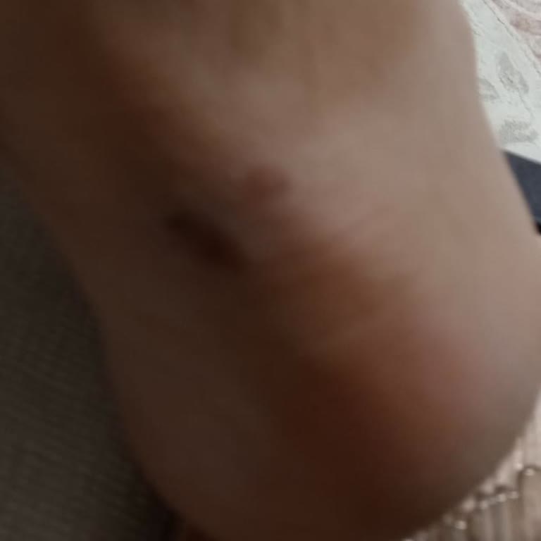 Garanti Dışı Su Sızdıran Kışlık Ayakkabı Ve Müşteri Hizmetlerinin İlgisizliği