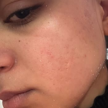 Farmakozmetika Orijinal Olmadığı Şüpheli Güneş Kremi İçin Tam İade Talebi