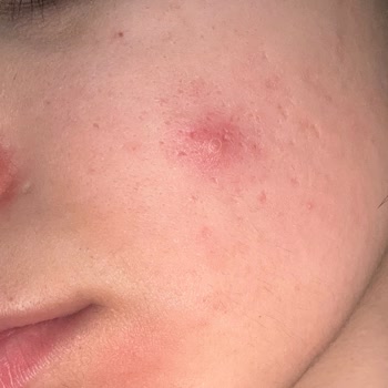 Farmakozmetika Orijinal Olmadığı Şüpheli Güneş Kremi İçin Tam İade Talebi